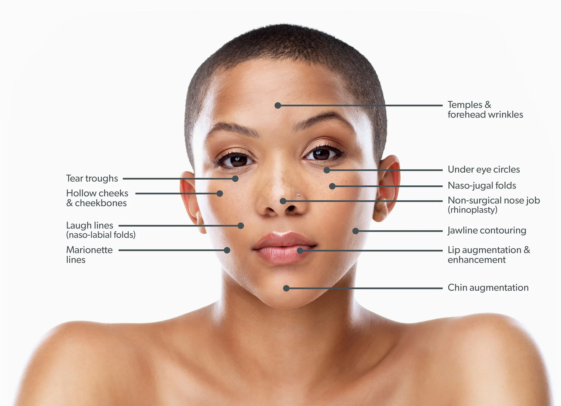 Facial cosmetic procedures diagram with annotations.