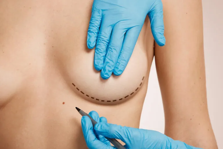Reduction Mammaplasty surgery