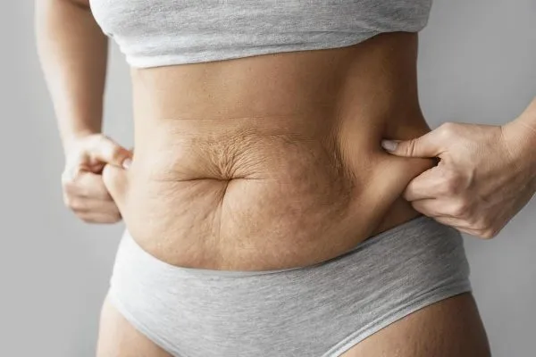 A woman holding her tummy, considering a tummy tuck