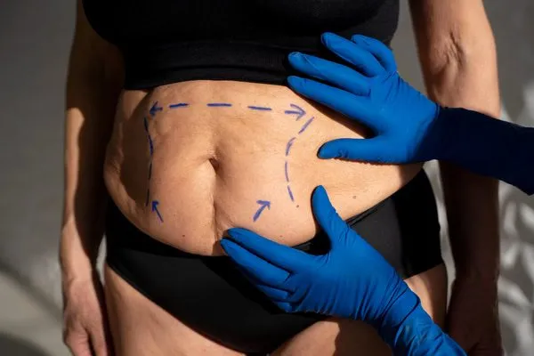 A person planning to have a surgery