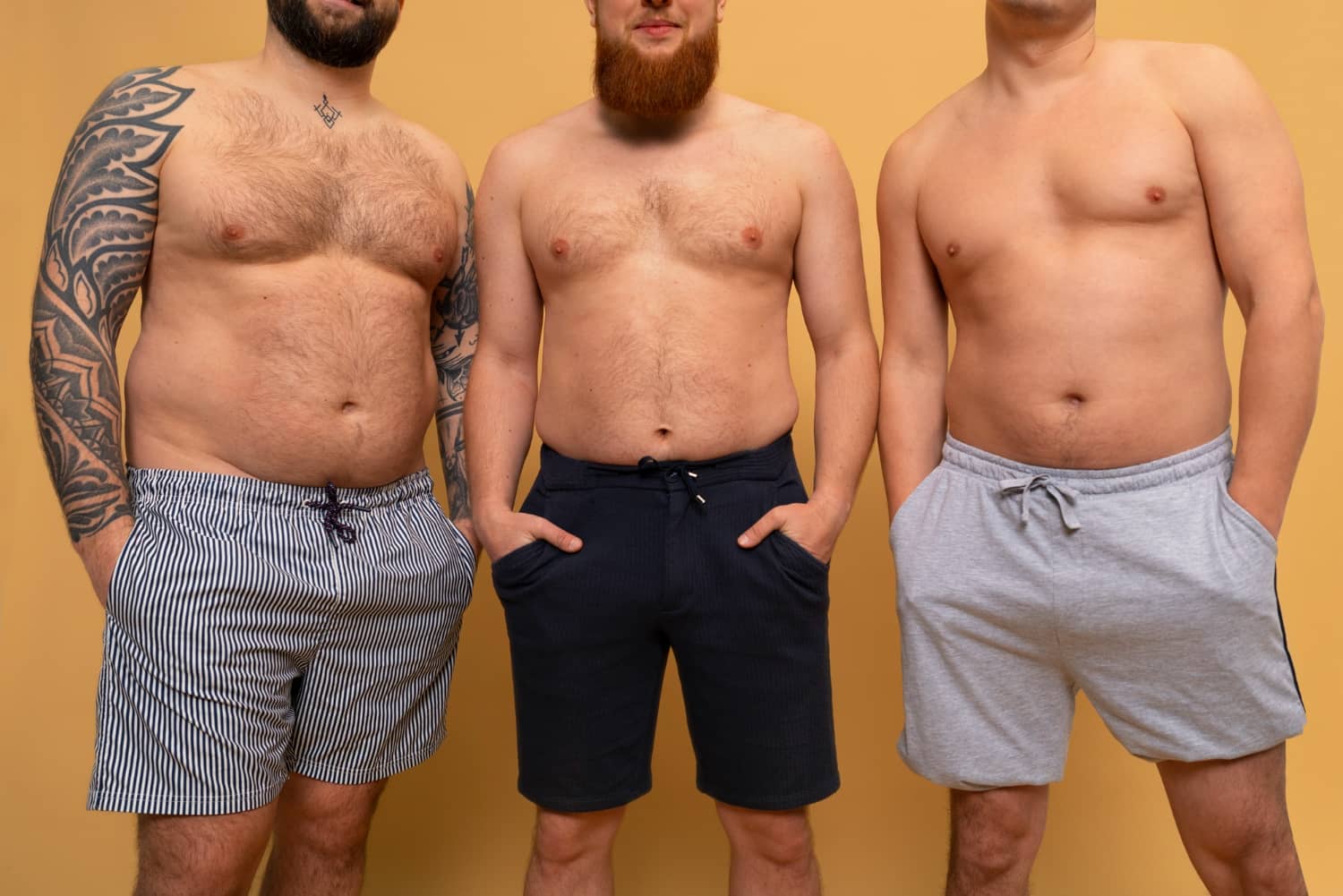 Front view men posing together before undergoing liposuction